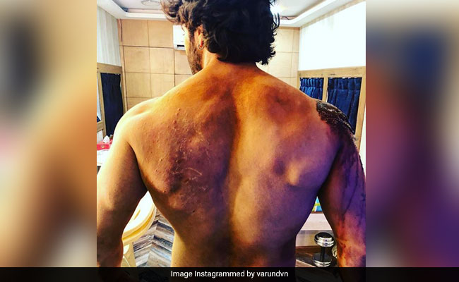 <I>Kalank</I>: Varun Dhawan Showcases His 'Battle Scars' In New Instagram Pic. Internet Is Very Impressed