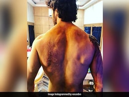 <I>Kalank</I>: Varun Dhawan Showcases His 'Battle Scars' In New Instagram Pic. Internet Is Very Impressed <I>Kalank</I>: Varun Dhawan Showcases His 'Battle Scars' In New Instagram Pic. Internet Is Very Impressed
