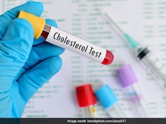 Cholesterol Insights: Ideal HDL And LDL Levels Explained