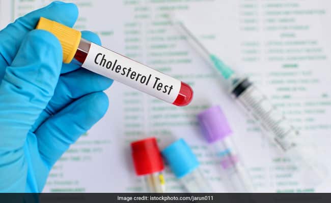High Cholesterol Can Lead To Several Diseases: Top 10 Foods That Can Help Lower Your Cholesterol Levels