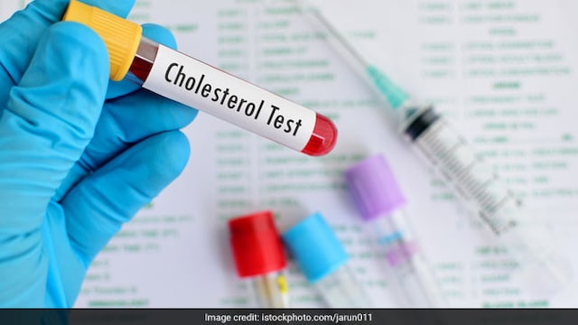 Heart health: Fibre rich foods can help you control bad cholesterol levels