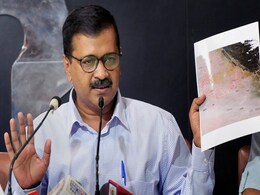 Day After Chilli Powder Attack, Arvind Kejriwal Says "Powerful People" Want Him Dead Day After Chilli Powder Attack, Arvind Kejriwal Says "Powerful People" Want Him Dead