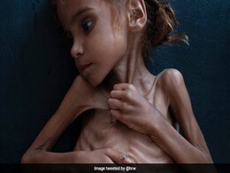 Starving 7-Year-Old Yemeni Girl, Whose Photo Sparked Outrage, Dies Starving 7-Year-Old Yemeni Girl, Whose Photo Sparked Outrage, Dies