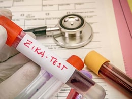 5 Zika Virus Cases Detected In Bengaluru: Karnataka Health Minister 5 Zika Virus Cases Detected In Bengaluru: Karnataka Health Minister