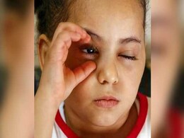 This Young Girl's Tragic Story Makes Her The Symbol Of Yemen War This Young Girl's Tragic Story Makes Her The Symbol Of Yemen War