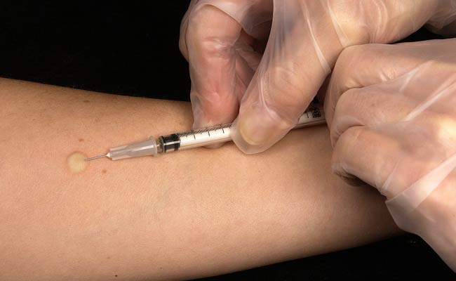 Vaccination Deaths: Case Filed Against Staff Of Hyderabad Health Centre