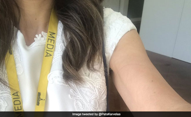 Here Is Why Women In Australia Are Sharing Photos Of Their Bare Arms