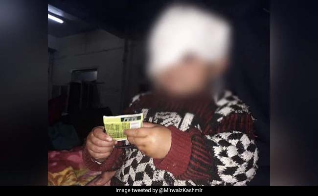 Pellet Removed From Jammu And Kashmir's Youngest Survivor's Eye