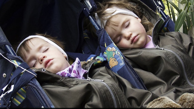 Conjoined twins are quite uncommon (Photo for representational purpose only)