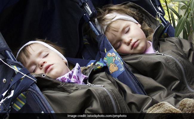 Conjoined twins are quite uncommon (Photo for representational purpose only)