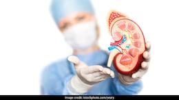 Kidney: Life After Kidney Transplant: What To Expect