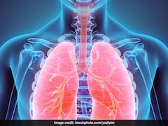 Lung Diseases You Are Prone To If Exposed To Air Pollution