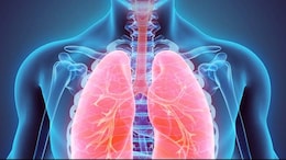 Lung Diseases You Are Prone To If Exposed To Air Pollution