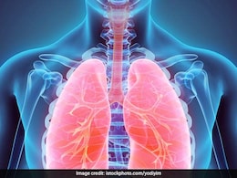 Lung Diseases You Are Prone To If Exposed To Air Pollution Lung Diseases You Are Prone To If Exposed To Air Pollution