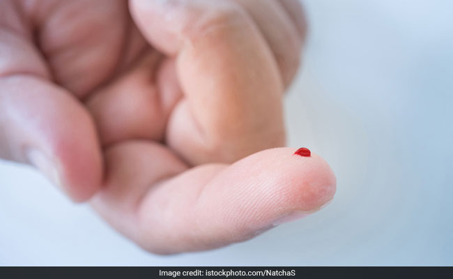 Anemia: What Is Anemia? Symptoms And Prevention | Diet Tips And Foods To Prevent Anemia