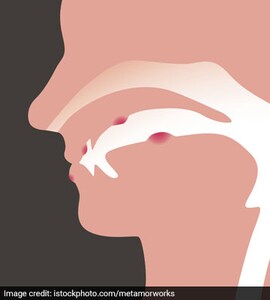 sore throat from chewing tobacco Invites Cancer Remedies for a sore throat
