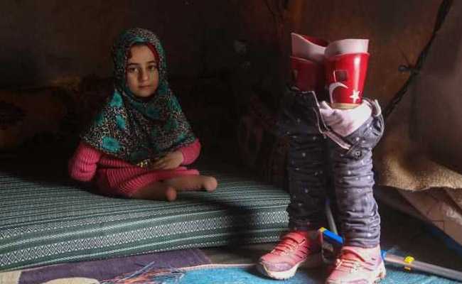 Syrian Girl Who Used Tin Cans For Legs Now Walks On New Prosthetics