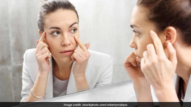 Thyroid eye disease is associated with the outward bulging of the eye