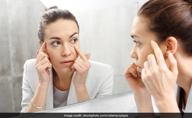 Thyroid eye disease is associated with the outward bulging of the eye