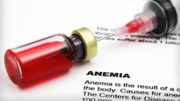 International Women's Day 2025: 3 in 5 Women In India At A Risk Of Anaemia; Here's How To Manage It