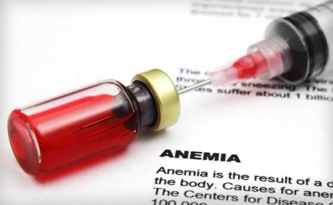Fingernail beds are ideal for detection of anaemia because they do not contain melanin