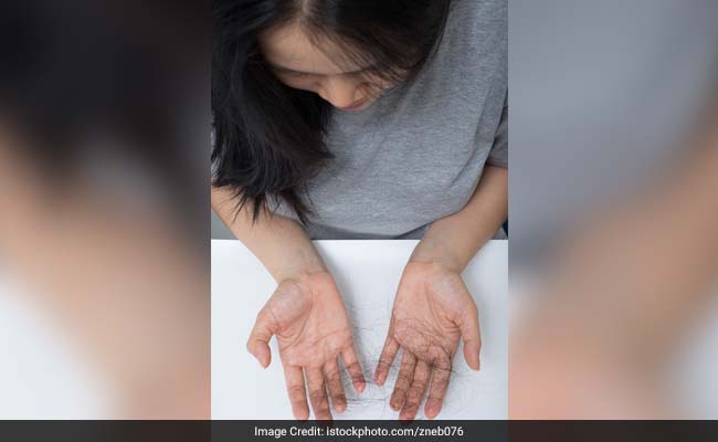Health Expert Luke Coutinho Shares These Amazing Home Remedies For Hair Fall