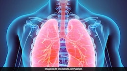 World Lung Cancer Day 2024: Theme, History, Significance, & Tips For Better Lung Health