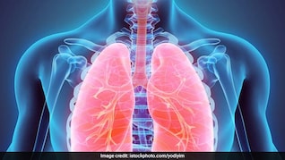 फेफड़ों को साफ करने के लिए क्या करें? ये 5 घरेलू उपाय अपनाएं और बनाएं लंग्स को सुपर पावरफुल