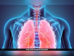 World Lung Day 2025: जानें - फेफड़ों की बीमारी के बारे में, क्या है इसके लक्षण और कारण World Lung Day 2025: जानें - फेफड़ों की बीमारी के बारे में, क्या है इसके लक्षण और कारण