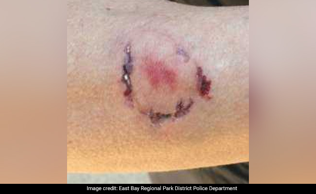 कुत्ते से डरकर भाग रही थी महिला, मालिक ने ही कूदकर काट लिया हाथ