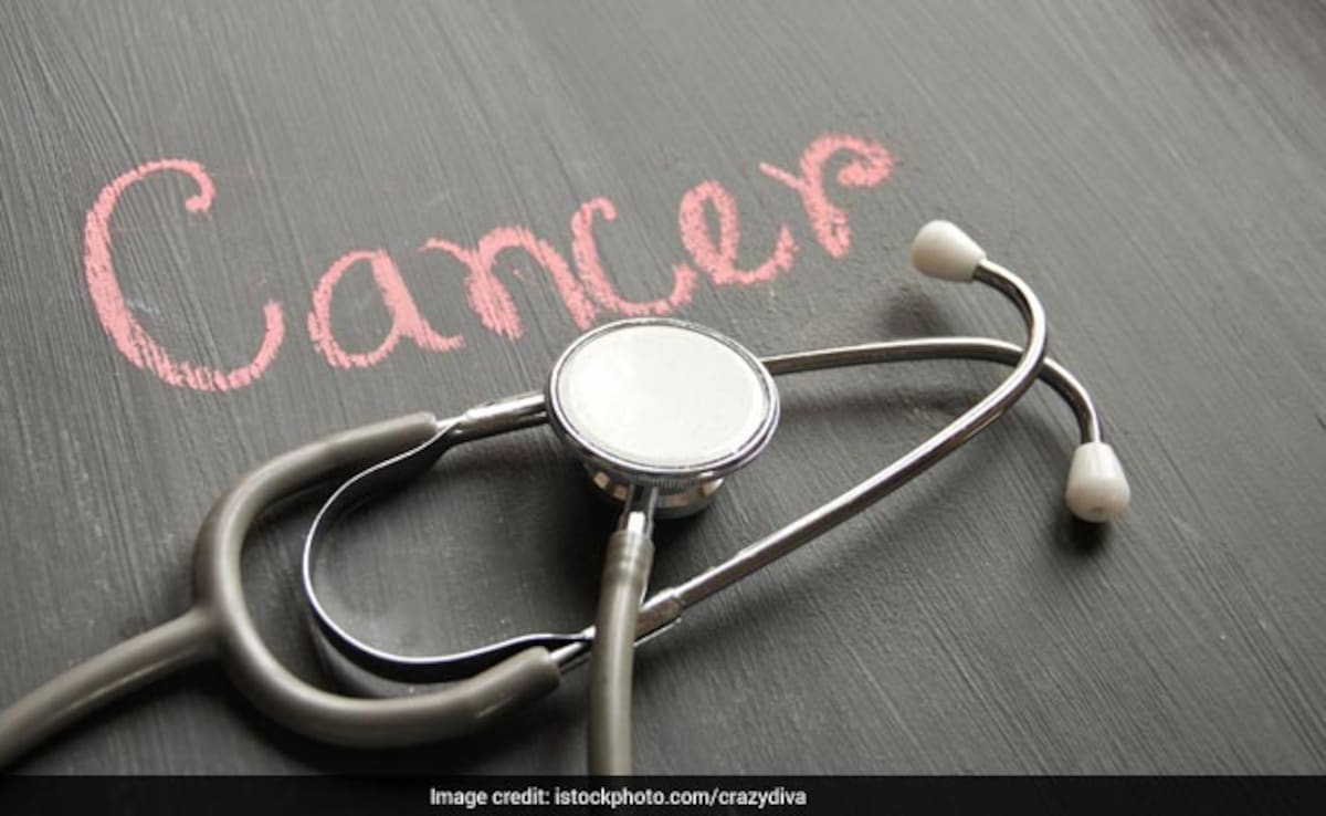 Аналният рак е рядка форма на рак която започва в