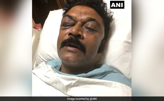Police Hunt For Karnataka Congress Lawmaker Who Attacked Party Colleague At Resort