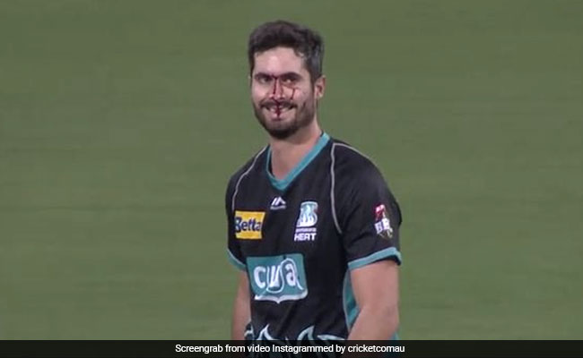 कैच पकड़ने के चक्कर में चेहरे पर लग गई गेंद, बहता रहा खून और हंसते रहा खिलाड़ी, देखें VIDEO