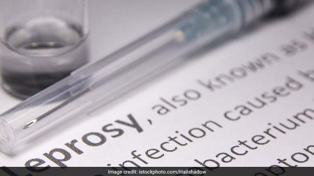 World Leprosy Day 2019: The disease is caused by the bacteria called Mycobacterium leprae