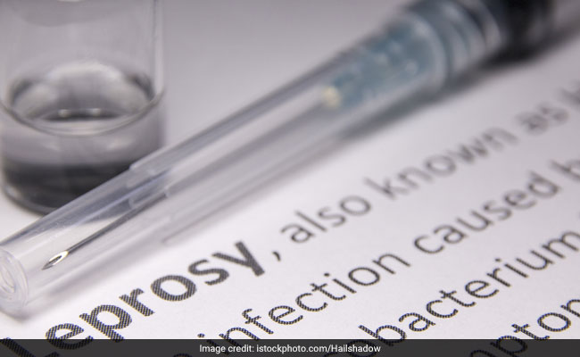 World Leprosy Day 2019: The disease is caused by the bacteria called Mycobacterium leprae