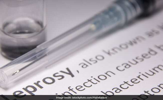 What Is Leprosy? कुष्ठ रोग के लक्षण, कारण, इलाज, दवा, उपचार और परहेज