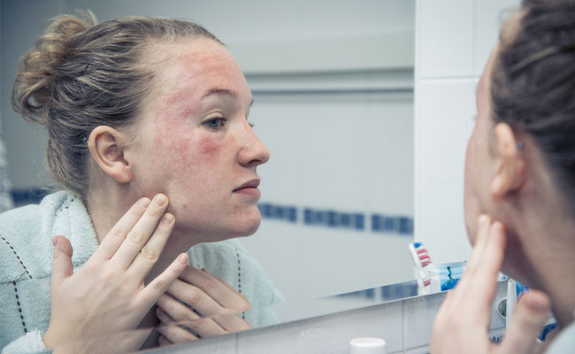 Development of new vaccines might help prevent shingles in cancer patients.