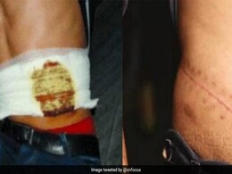 iPhone खरीदने के लिए शख्स ने बेच दी अपनी किडनी, फिर हुआ हैरान करने वाला हादसा iPhone खरीदने के लिए शख्स ने बेच दी अपनी किडनी, फिर हुआ हैरान करने वाला हादसा