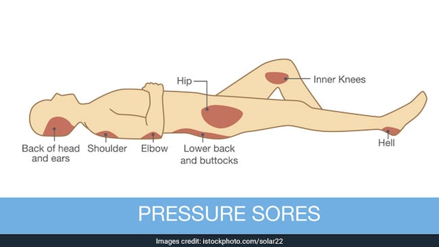 Shift your position frequently to avoid bed sores