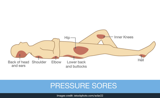Shift your position frequently to avoid bed sores