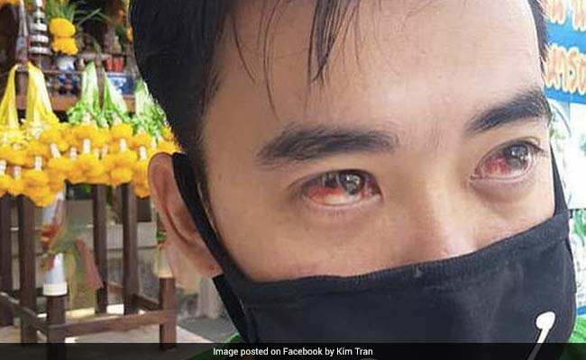 Bleeding Noses And Blood-Red Eyes As Bangkok Battles Toxic Air