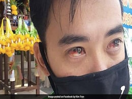 Bleeding Noses And Blood-Red Eyes As Bangkok Battles Toxic Air Bleeding Noses And Blood-Red Eyes As Bangkok Battles Toxic Air