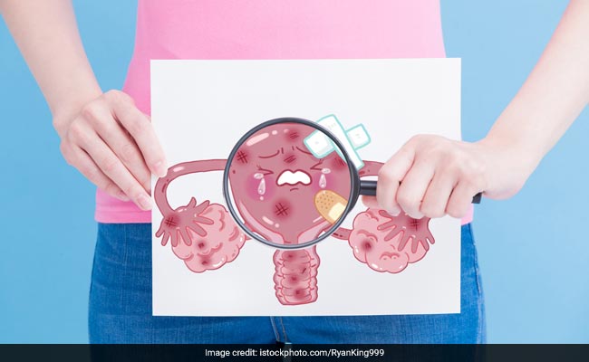 Sign Of Cervical Cancer: लेडीज पेट के इस एरिया में अचनाक तेज दर्द होता है, तो सतर्क हो जाएं, सर्वाइकल कैंसर का है शक
