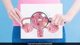 Women's Health: Cervical Cancer Linked To HPV? Keep These Things In Mind To Stay Safe