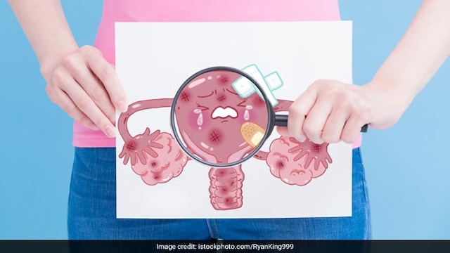 Abnormal vaginal bleeding, such as between periods or after menopause may be sign of CC