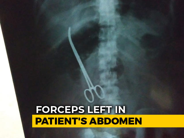 Surgeons Left Forceps In Hyderabad Woman. X-Ray Found It After 3 Months