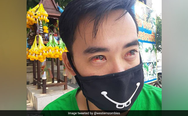 स्मॉग से लोगों की हालत खराब, आंखों और नाक से निकलने लगा है खून, Photo दहला देगी आपको