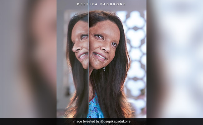 <i>Chhapaak</i> First Look: Deepika Padukone As Malti Will Be Remembered Forever