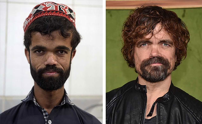 Pakistani Tyrion Lannister? Man Finds Fame As '<i>Game Of Thrones</i>' Lookalike