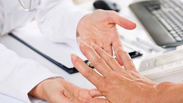 People who are obese appear to be at a higher risk of developing rheumatoid arthritis.